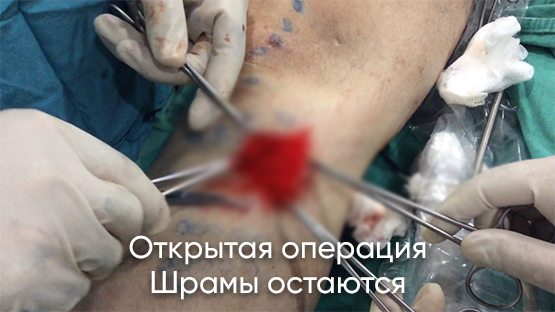 Лазерное лечение варикозной болезни в Барнауле